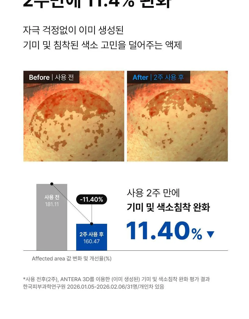 [턴오버주기개선] 동아제약 색소침착 프로 액제 30ml 상세페이지 13